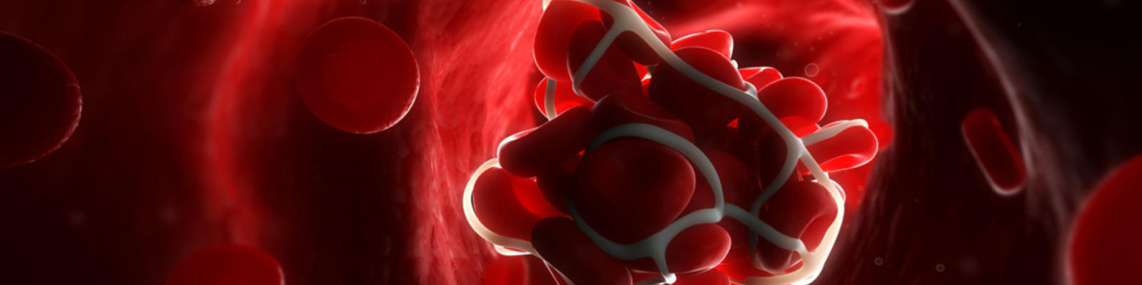 A computerised render of a blood clot in the bloodstream